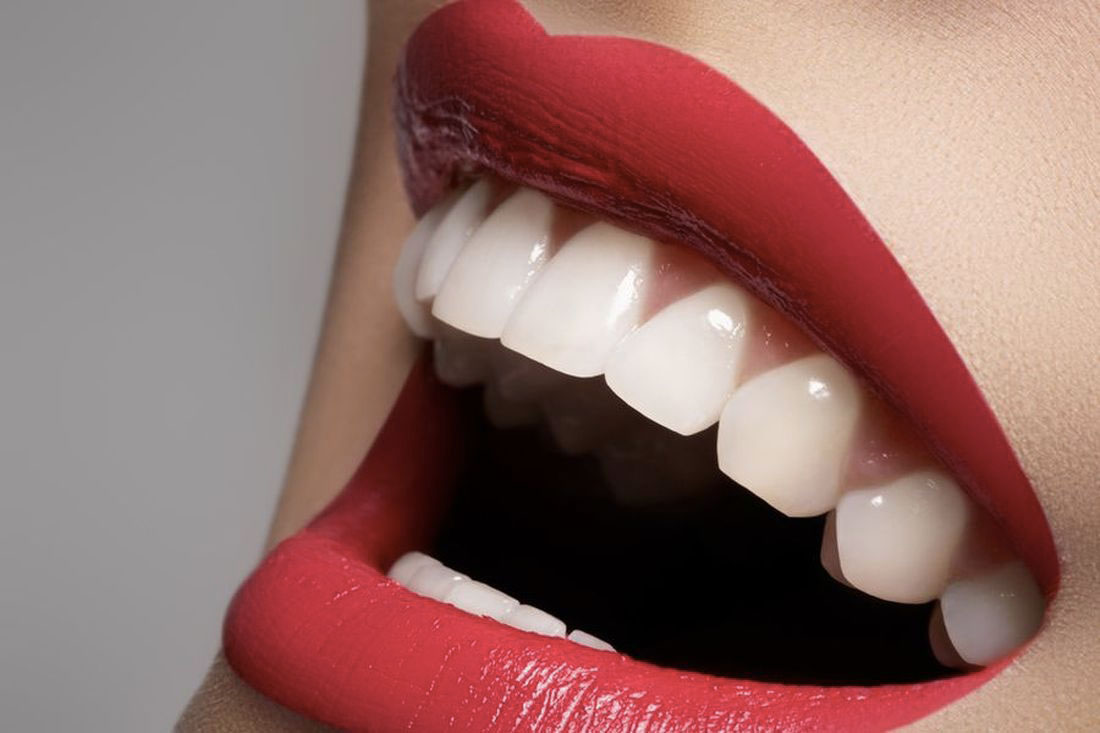 dents-blanches-1.jpg dents-blanches-1.jpg